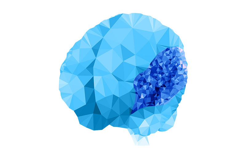 Polymicrogyria-blue